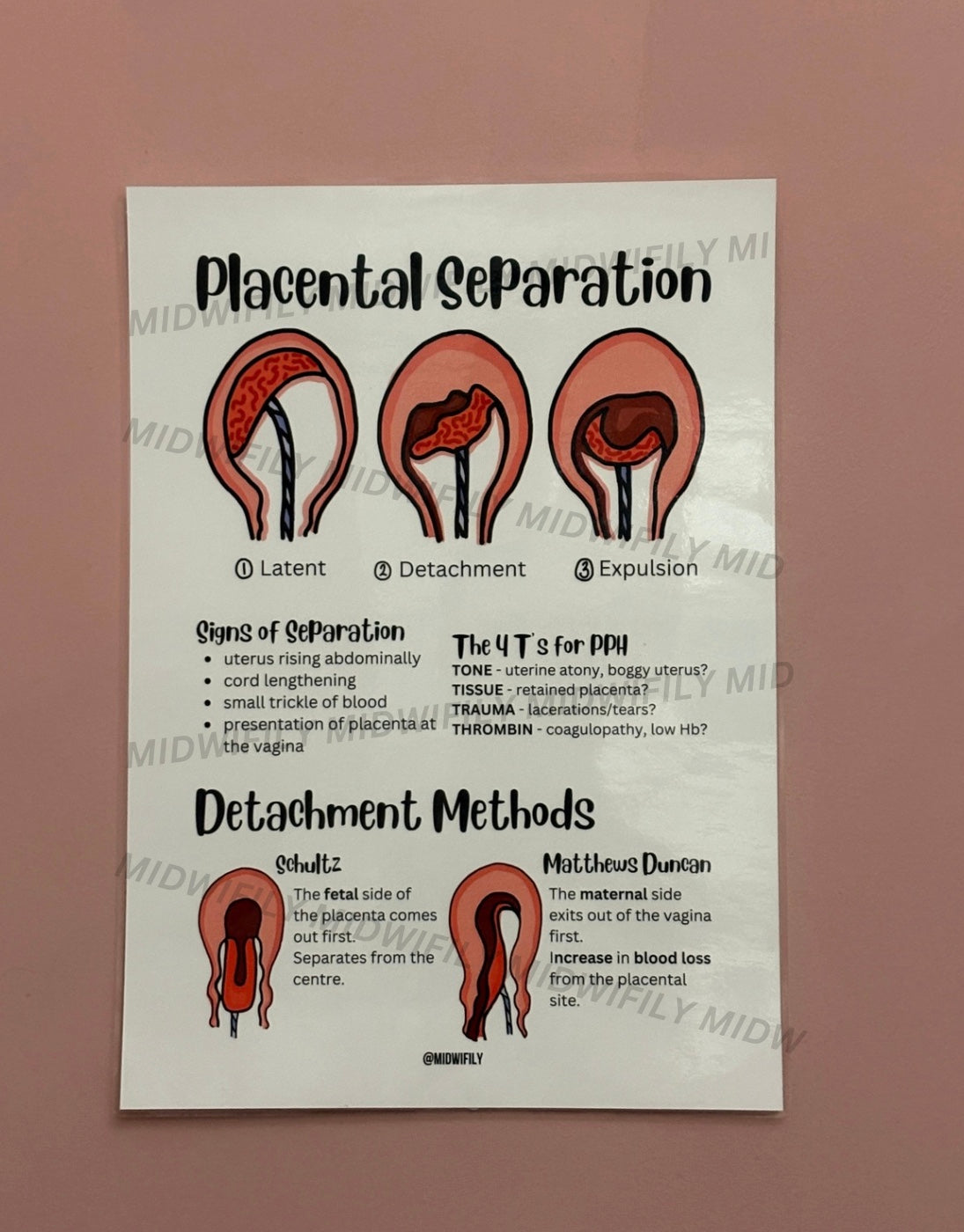 Placental Separation Poster