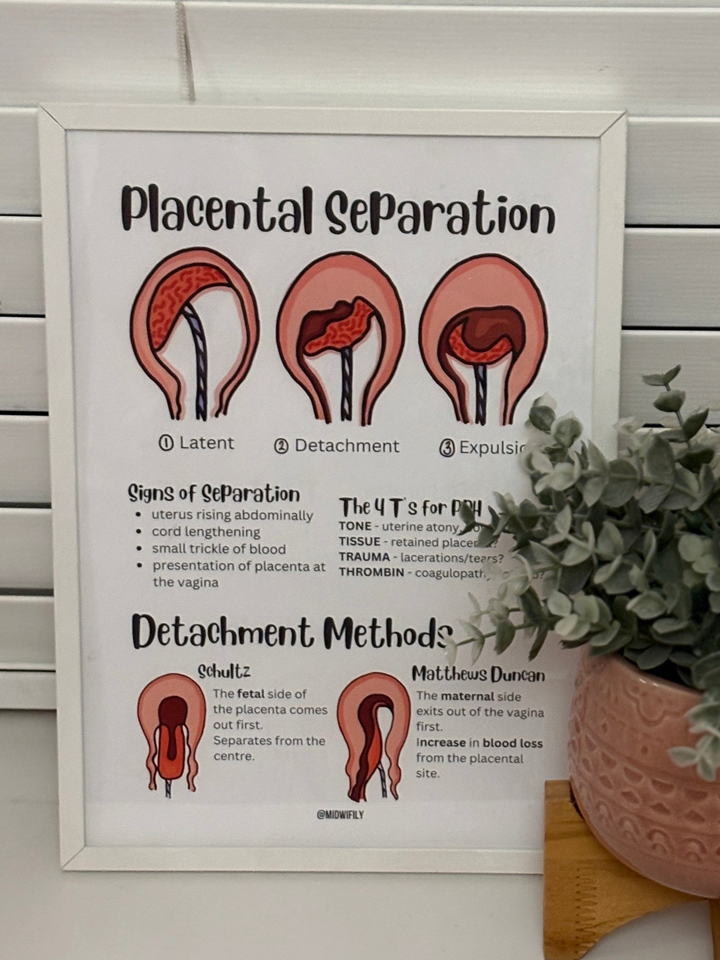 Placental Separation Poster