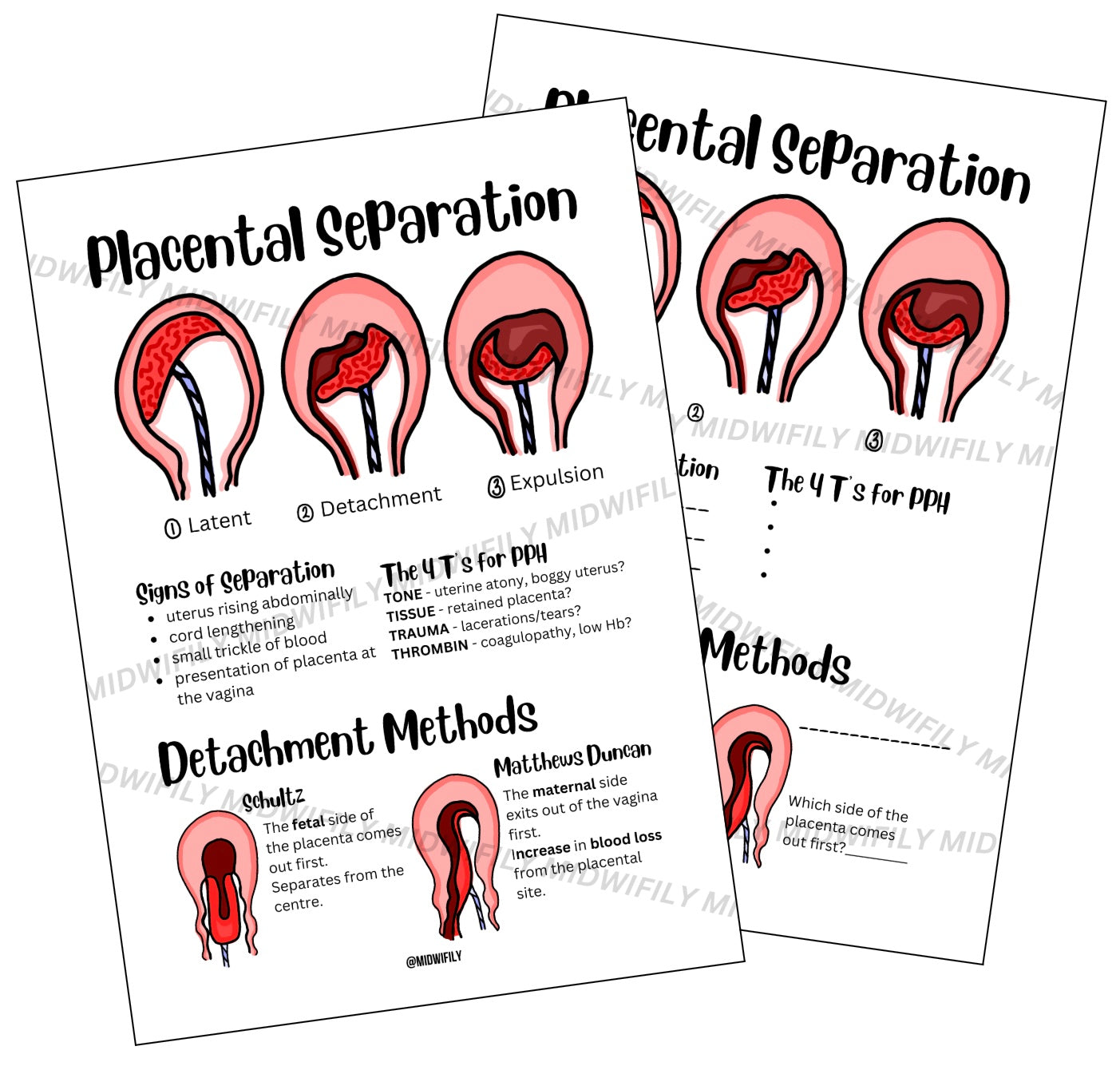 Placental Separation Poster
